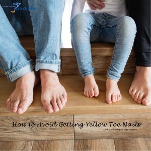 3 ways to Avoid Unsightly Yellow Toe Nails