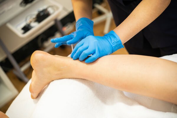 Dry Needling