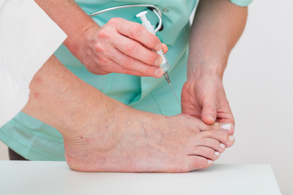 Prolotherapy